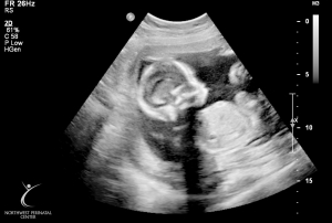 ultrasound 2014-12-10 03.jpg